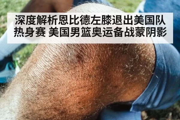 深度解析恩比德左膝退出美国队热身赛 美国男篮奥运备战蒙阴影